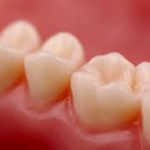 危険信号！歯茎からの出血を止める自宅でできる4つの手順と正しい治療法