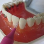 歯間ブラシの徹底解説！30歳過ぎたら口臭や歯周病リスクを排除しよう