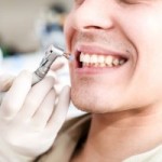 健康な歯茎を維持する為の7つの習慣