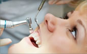 これって虫歯？削らない初期虫歯とキレイに治す虫歯治療