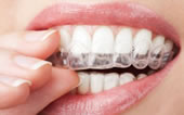 あなたの八重歯はこうして治る写真でわかる矯正治療