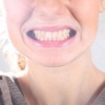 歯の食いしばりによって起こる危険／１１の症状と治療法