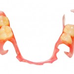 部分入れ歯は必要か？歯がないなら早く付けるべき恐ろしい６つの理由