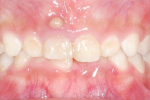 乳歯がおかしい 乳歯に起こる歯や歯茎 噛み合わせの全ての異常と対応策