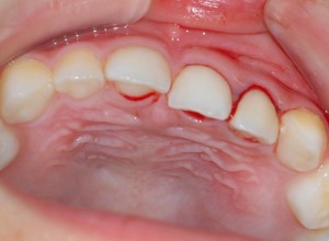 乳歯がおかしい 乳歯に起こる歯や歯茎 噛み合わせの全ての異常と対応策