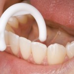 実はすごい！糸ようじで効果的に虫歯や歯周病を防ぐ方法