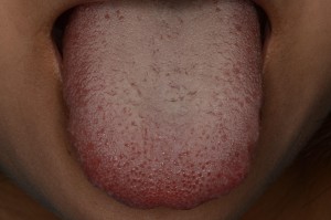 舌 磨き 効果