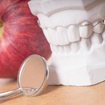 虫歯治療！浅い虫歯から深い虫歯の治療法と最新歯科治療