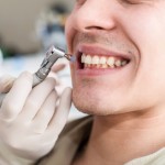 ３ヶ月に一度！歯医者でPMTCを行った方がいい６つの理由と費用や手順