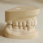大人の矯正歯科の選び方と歯周病など注意すべき７つのこと