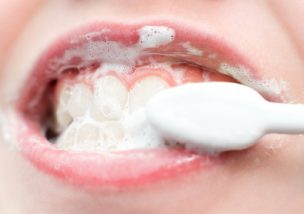 歯肉炎とは 歯茎が腫れる原因と症状 自宅で治す方法