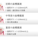 歯を抜かずに歯槽膿漏(歯周病)を治療する３つのステップと薬の効果